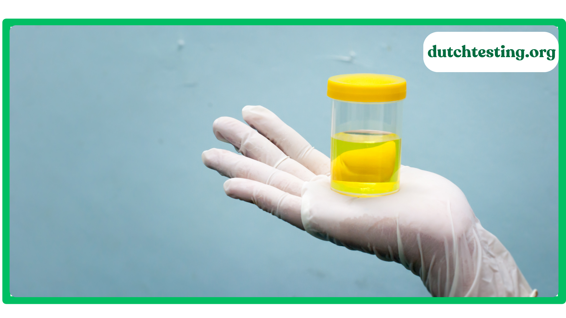 Is The DUTCH Test Worth It and Accurate Is The DUTCH Test Worth It and Accurate