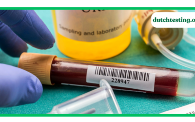 Is the DUTCH Test Right for You? Who Actually Needs It